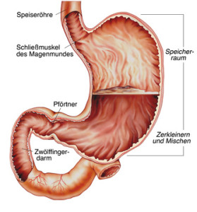 Gastritis-Magenschleimhautentzündung